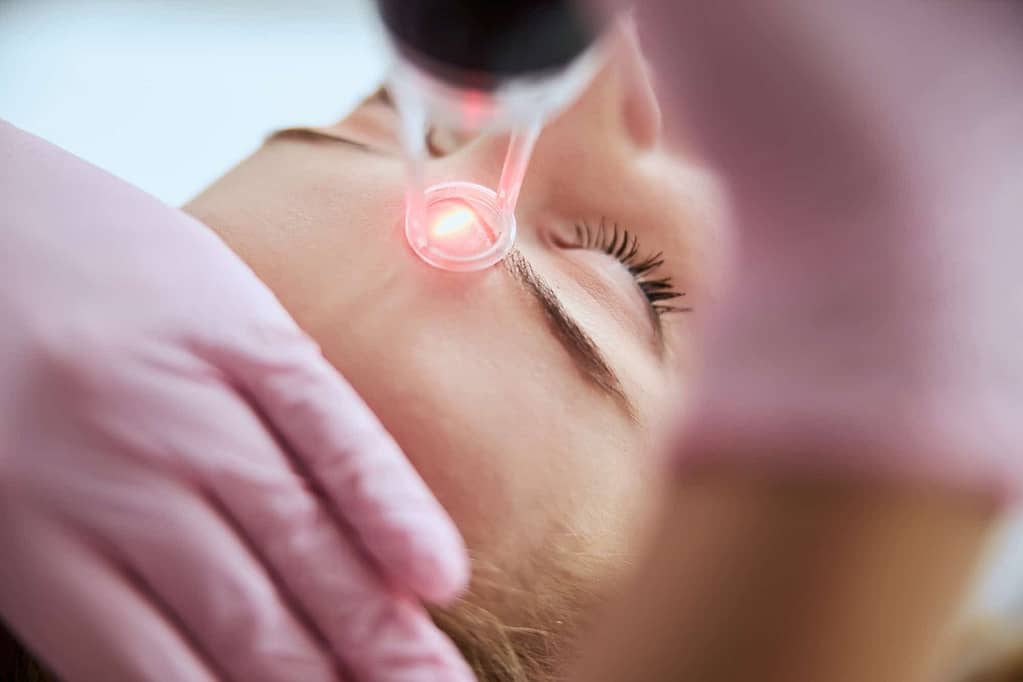 Caucasian female getting a laser skin treatment
